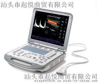 迈瑞B超M5便携笔记本式彩色多普勒超声诊断仪